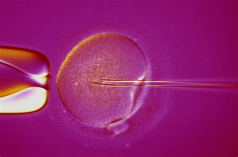 Most Common Fertility Treatments How They Work And How Much They Cost