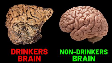 How Alcohol Affects The Human Brain Science Explained Youtube