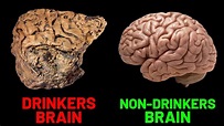 How Alcohol Affects The Human Brain (SCIENCE EXPLAINED) - YouTube