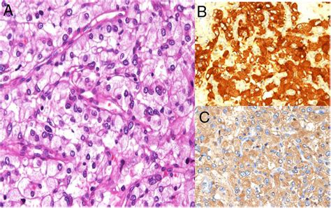 Hematoxylin And Eosin Stain Showing Cells With A Well Defined Download Scientific Diagram