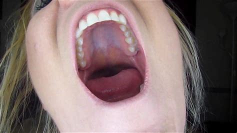 Yawning Roof Mouth New Xnxx Hd Porn Video 7f Xhamster