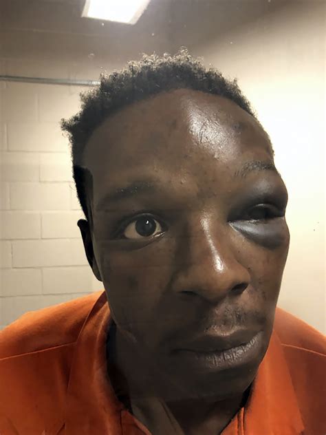 Days after he was beaten by Georgia sheriff's deputy, Roderick Walker