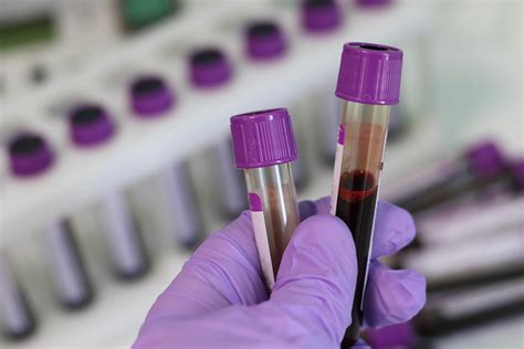 Blood Tests Explained Lab Testing Api