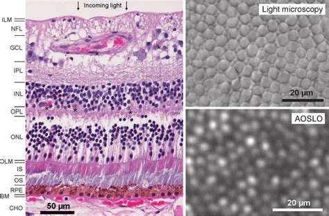1 The Retina And Photoreceptor Mosaic A Hematoxylin And Eosin Stain