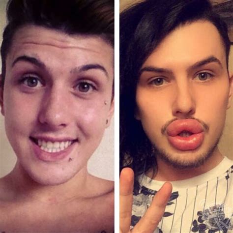 New Trend Makes Guys Enlarge Their Lips Top Banger Top Banger