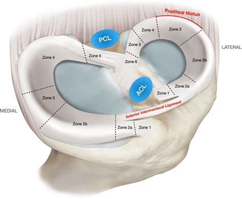 Medial And Lateral Meniscus Zones And Relevant Anatomical Relations