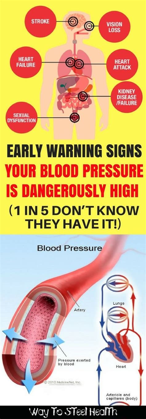 EARLY WARNING SIGNS YOUR BLOOD PRESSURE IS DANGEROUSLY HIGH (1 IN 5 DON'T KNOW THEY HAVE IT ...