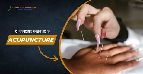 6 Surprising Benefits Of Acupuncture You Didnt Know About