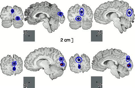 Coinciding Early Activation Of The Human Primary Visual Cortex And