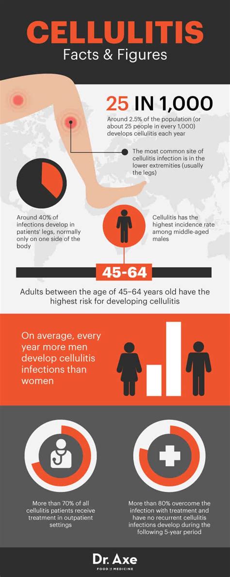 Cellulitis Symptoms Causes Risk Factors Dr Axe