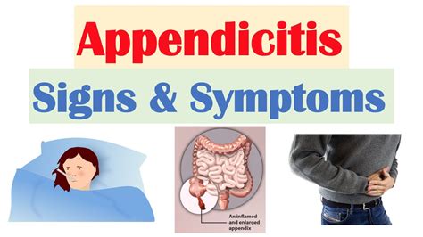 Appendicitis Signs And Symptoms And Why They Occur Youtube
