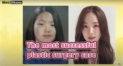 Did These Korean Actors Ruin Their Faces With Too Much Plastic Surgery