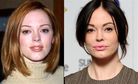 Rose Mcgowan Before And After Plastic Surgery 10 Celebrity Plastic Surgery Online