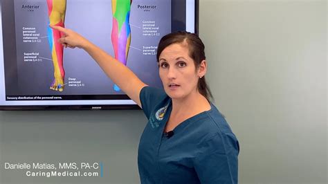 Knee Pain From Peroneal Nerve Irritation Treated With Nerve Release