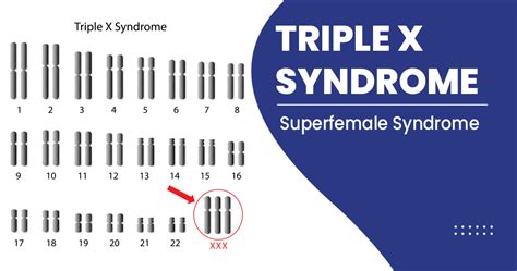What Is Triple X Syndrome