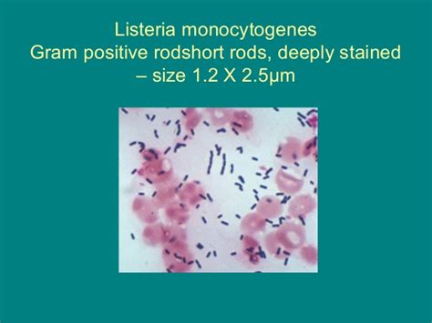 Unlike most other harmful bacteria, it can grow on foods stored in a refrigerator. Gram Stains