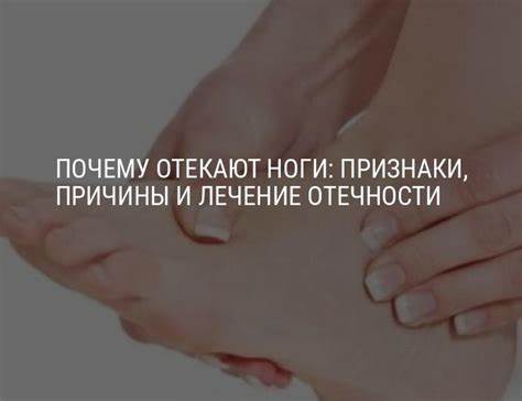 Ноги похудели при беременности