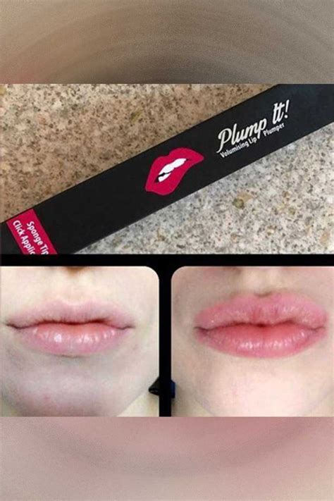 Lip Plumper For Fuller And Hydrated Lips Yummylooks