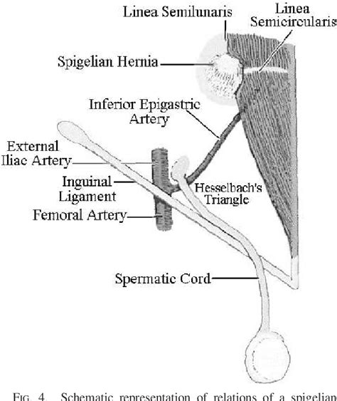 Spigelian Hernia Surgical Anatomy Embryology And Technique Of Repair