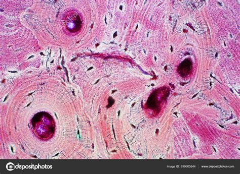 Histology Human Compact Bone Tissue Microscope View Education Muscle
