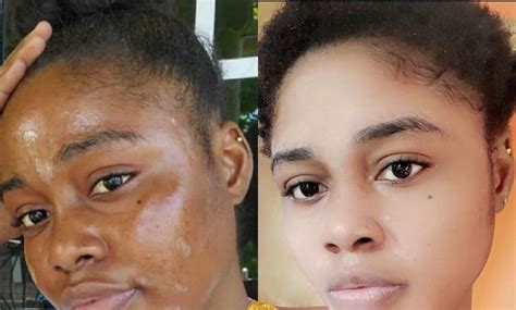 Strong Skin Lightening Cream Effective Results In 5 Days Etsy