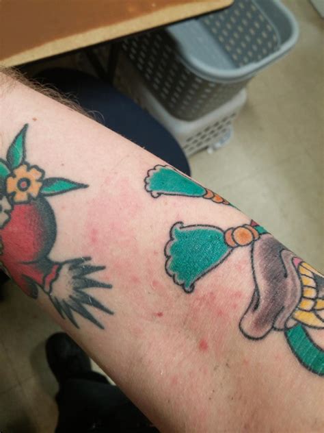 What Causes A Tattoo Rash And How Is It Treated