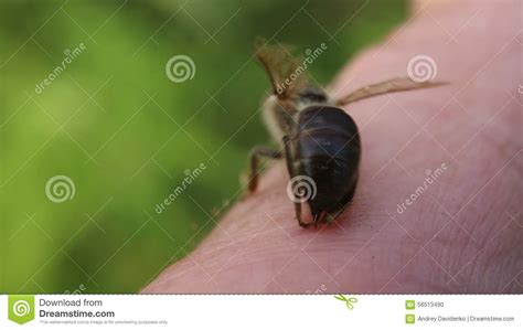 bee stings a man stock footage video of skin finger 56513490