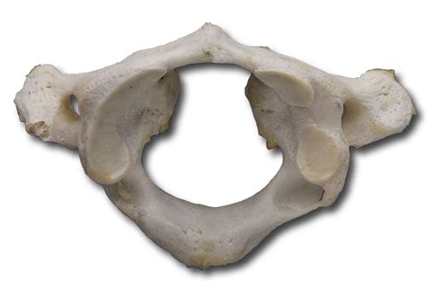 Atlas and axis vertebrae are two distinct elements of the vertebral column. Anatomy Pathways - Vertebral Column