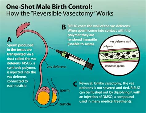 In 2017 Birth Control For Men Will Hit The Market