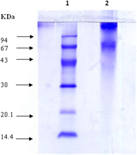 Sds Polyacrylamide Gel Electrophoresis For The Partially Purified