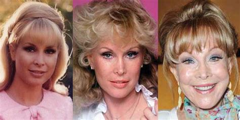 Barbara Eden Plastic Surgery Before And After Pictures 2024