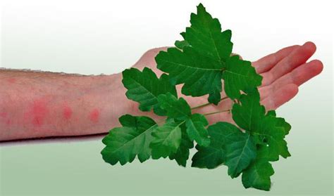 How To Treat And Avoid Poison Ivy Poison Oak And Poison Sumac