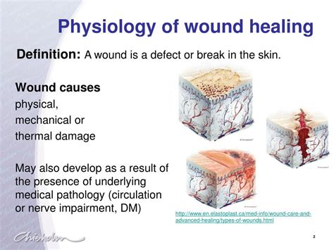 Ppt Physiology Of Wound Healing Powerpoint Presentation Free