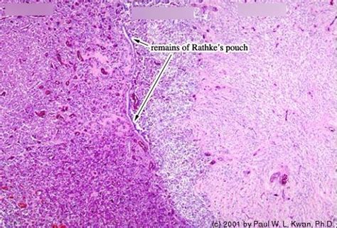 Histology Of Pituitary Gland The Best Porn Website