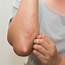 NEW In COVID 19 Skin Rashes Linked To Virus  Apex Dermatology &