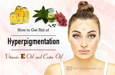 34 Tips How To Get Rid Of Hyperpigmentation On Face Neck Legs Back