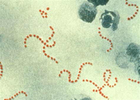 Bacterial Infections Gram Positive Cocci Medical Library