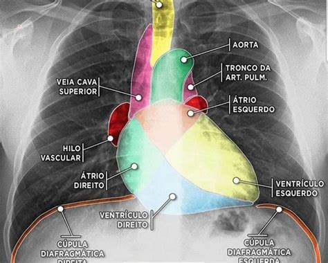 Pin By Luisvaldivieso On Tórax Radiology Anatomy Medicine