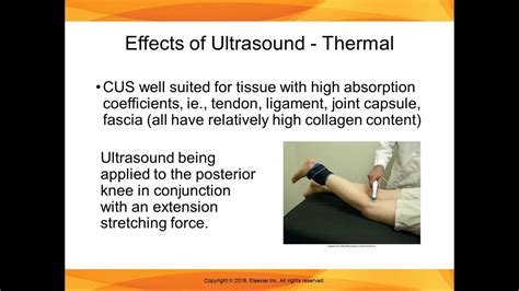 Chapter 9 Lecture Part 3 Thermal And Non Thermal Effects Of Ultrasound