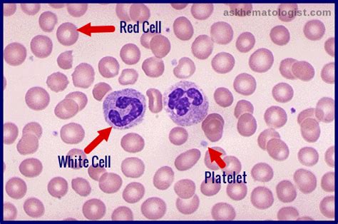 Blood Cells Ask Hematologist Understand Hematology