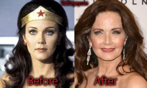 Lynda Carter Plastic Surgery Before And After Facelift Pictures