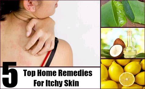 Top 5 Home Remedies For Itchy Skin Natural Cure And Herbal Treatment