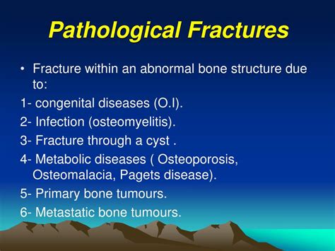 Ppt Principles Of Fractures Powerpoint Presentation Free Download