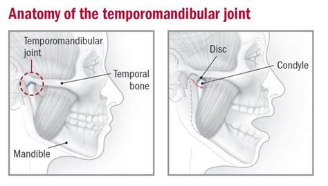 Temporomandibular Joint Disorder Treatment In Gurgaon Pal Physio