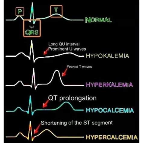 371 Likes 11 Comments Med School Posts Medschoolstudent On