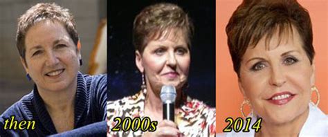 Joyce Meyer Plastic Surgery Before And After Top Piercings