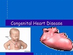 Congenital Heart Disease Ppt Download - engup
