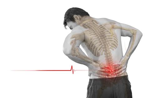 Treating Back Pain Physicians Immediate Care