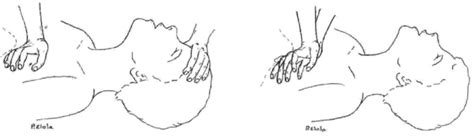 Chest Compressions With One Hand In The Child Download Scientific