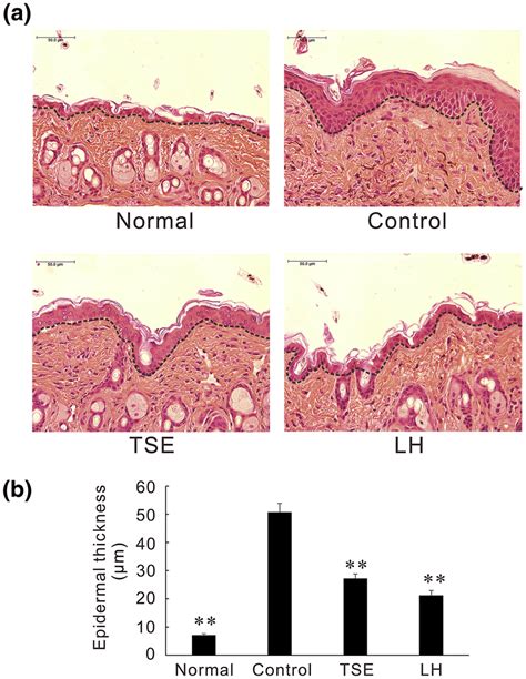 Cross‐sectional Image Of Mouse Facial Skin A He‐staining Of Mouse